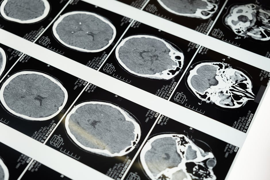 Thermal Treatment Effectiveness: Clinical Studies and Evidence Review detailed brain mri scans displayed on a lightbox showcasing